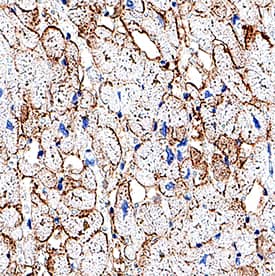 Immunohistochemistry gamma Sarcoglycan Antibody (1112101) [Unconjugated]