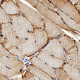Immunohistochemistry gamma Sarcoglycan Antibody (1112101) [Unconjugated]