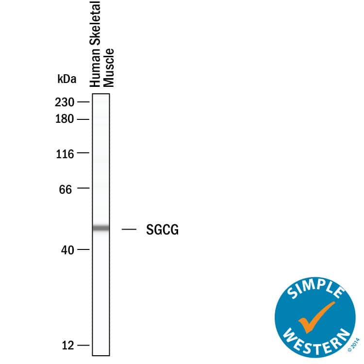 Simple Western gamma Sarcoglycan Antibody (1112101) [Unconjugated]