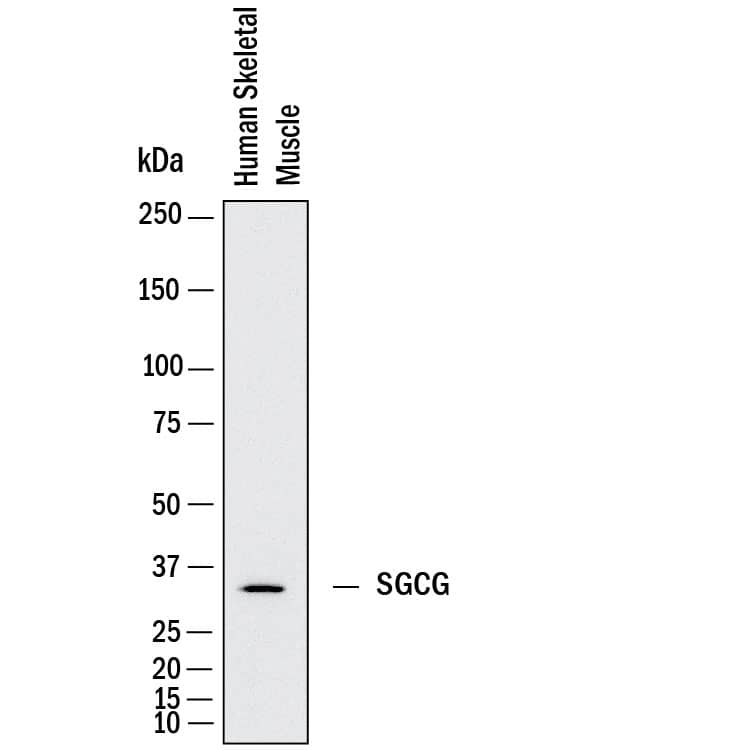 Western Blot gamma Sarcoglycan Antibody (1112101) [Unconjugated]