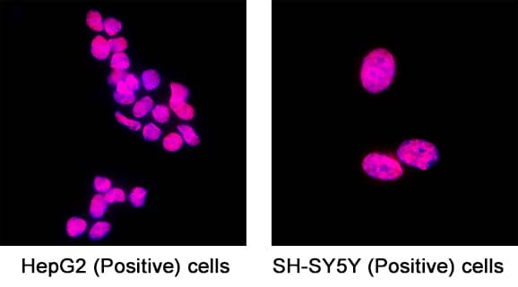 SOX12 was detected in immersion fixed HepG2 human hepatocellular carcinoma cell line (Positive) and SH‑SY5Y human neuroblastoma cell line (Positive) using Mouse Anti-Human SOX12 Monoclonal Antibody (Catalog # MAB11733) at 8 µg/ml for 3 hours at room temperature. Cells were stained using the NorthernLights&trade; 557-conjugated Anti-Mouse IgG Secondary Antibody (red; Catalog # NL007) and counterstained with DAPI (blue). Specific staining was localized to the nucleus. View our protocol for Fluorescent ICC Staining of Cells on Coverslips.