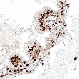 SOX12 was detected in immersion fixed paraffin-embedded sections of human breast using Mouse Anti-Human SOX12 Monoclonal Antibody (Catalog # MAB11733) at 5 µg/ml for 1 hour at room temperature followed by incubation with the Anti-Mouse IgG VisUCyte&trade; HRP Polymer Antibody (Catalog # VC001) or the HRP-conjugated Anti-Mouse IgG Secondary Antibody (Catalog # HAF007). Before incubation with the primary antibody, tissue was subjected to heat-induced epitope retrieval using VisUCyte Antigen Retrieval Reagent-Basic (Catalog # VCTS021). Tissue was stained using DAB (brown) and counterstained with hematoxylin (blue). Specific staining was localized to the nucleus. View our protocol for IHC Staining with VisUCyte HRP Polymer Detection Reagents.
