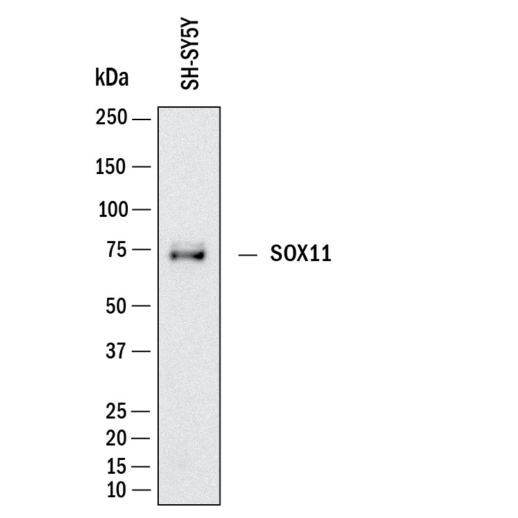 Western Blot shows lysates of SH‑SY5Y human neuroblastoma cell line. PVDF membrane was probed with 2 µg/ml of Mouse Anti-Human SOX11 Monoclonal Antibody (Catalog # MAB11734) followed by HRP-conjugated Anti-Mouse IgG Secondary Antibody (Catalog # HAF018). A specific band was detected for SOX11 at approximately 70 kDa (as indicated).  This experiment was conducted under reducing conditions and using Western Blot Buffer Group 1.