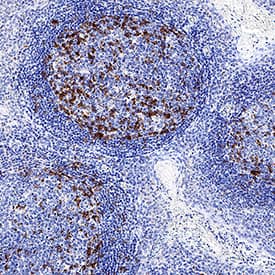 PD‑1 was detected in immersion fixed paraffin-embedded sections of human tonsil using Mouse Anti-Human PD‑1 Monoclonal Antibody (Catalog # MAB11741) at 5 µg/ml for 1 hour at room temperature followed by incubation with the Anti-Mouse IgG VisUCyte™ HRP Polymer Antibody (Catalog # VC001) or the HRP-conjugated Anti-Mouse IgG Secondary Antibody (Catalog # HAF007). Before incubation with the primary antibody, tissue was subjected to heat-induced epitope retrieval using VisUCyte Antigen Retrieval Reagent-Basic (Catalog # VCTS021). Tissue was stained using DAB (brown) and counterstained with hematoxylin (blue). Specific staining was localized to the membrane. View our protocol for IHC Staining with VisUCyte HRP Polymer Detection Reagents.