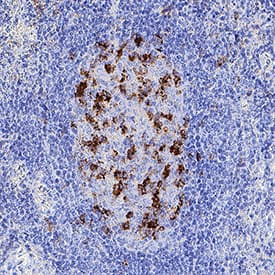 PD‑1 was detected in immersion fixed paraffin-embedded sections of human lymph node using Mouse Anti-Human PD‑1 Monoclonal Antibody (Catalog # MAB11741) at 5 µg/ml for 1 hour at room temperature followed by incubation with the Anti-Mouse IgG VisUCyte™ HRP Polymer Antibody (Catalog # VC001) or the HRP-conjugated Anti-Mouse IgG Secondary Antibody (Catalog # HAF007). Before incubation with the primary antibody, tissue was subjected to heat-induced epitope retrieval using VisUCyte Antigen Retrieval Reagent-Basic (Catalog # VCTS021). Tissue was stained using DAB (brown) and counterstained with hematoxylin (blue). Specific staining was localized to the membrane. View our protocol for IHC Staining with VisUCyte HRP Polymer Detection Reagents.