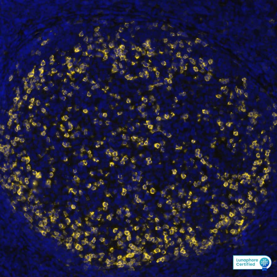 PD-1 was detected in immersion fixed paraffin-embedded sections of Human tonsil using Mouse Anti-Human PD-1, Monoclonal Antibody (Catalog #MAB11741) at 20ug/mL at 37 ° Celsius for 8 minutes. Before incubation with the primary antibody, tissue underwent an all-in-one dewaxing and antigen retrieval preprocessing using PreTreatment Module (PT Module) and Dewax and HIER Buffer H (pH 9; Epredia Catalog # TA-999-DHBH). Tissue was stained using the Alexa Fluor™ 647 Goat anti-Mouse IgG Secondary Antibody at 1:200 at 37 ° Celsius for 2 minutes. (Yellow; Lunaphore Catalog # DR647MS) and counterstained with DAPI (blue; Lunaphore Catalog # DR100). Specific staining was localized to the membrane. Protocol available in COMET™ Panel Builder.
