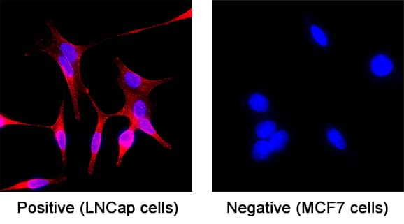 Immunocytochemistry STEAP2 Antibody (1114318) [Unconjugated]