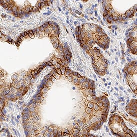 Immunohistochemistry STEAP2 Antibody (1114318) [Unconjugated]