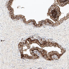 Immunohistochemistry STEAP2 Antibody (1114318) [Unconjugated]