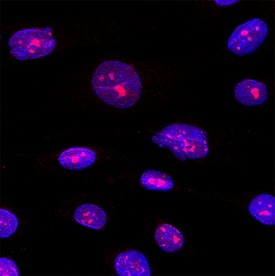 WIZ was detected in immersion fixed MG‑63 human osteosarcoma cell line using Mouse Anti-Human WIZ Monoclonal Antibody (Catalog # MAB11743) at 8 µg/ml for 3 hours at room temperature. Cells were stained using the NorthernLights&trade; 557-conjugated Anti-Mouse IgG Secondary Antibody (red; Catalog # NL007) and counterstained with DAPI (blue). Specific staining was localized to the nucleus. View our protocol for Fluorescent ICC Staining of Cells on Coverslips.