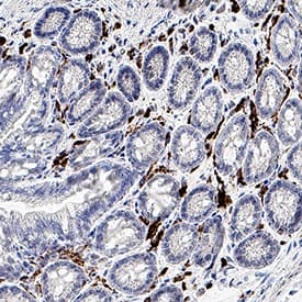 CD163 was detected in perfusion fixed paraffin-embedded sections of mouse colon using Rat Anti-Mouse CD163 Monoclonal Antibody (Catalog # MAB11745) at 5 µg/ml overnight at 4 &deg;C. Before incubation with the primary antibody, tissue was subjected to heat-induced epitope retrieval using VisUCyte Antigen Retrieval Reagent-Basic (Catalog # VCTS021). Tissue was stained using the HRP-conjugated Anti-Rat IgG Secondary Antibody (Catalog # HAF005) and counterstained with hematoxylin (blue). Specific staining was localized to the cell surface. View our protocol for Chromogenic IHC Staining of Paraffin-embedded Tissue Sections.