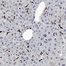 CD163 was detected in perfusion fixed paraffin-embedded sections of mouse liver using Rat Anti-Mouse CD163 Monoclonal Antibody (Catalog # MAB11745) at 5 µg/ml overnight at 4 &deg;C. Before incubation with the primary antibody, tissue was subjected to heat-induced epitope retrieval using VisUCyte Antigen Retrieval Reagent-Basic (Catalog # VCTS021). Tissue was stained using the HRP-conjugated Anti-Rat IgG Secondary Antibody (Catalog # HAF005) and counterstained with hematoxylin (blue). Specific staining was localized to the cell surface of Kupffer cells. View our protocol for Chromogenic IHC Staining of Paraffin-embedded Tissue Sections.
