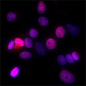Immunocytochemistry MTAP Antibody (1113601) [Unconjugated]