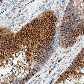 Immunohistochemistry MTAP Antibody (1113601) [Unconjugated]