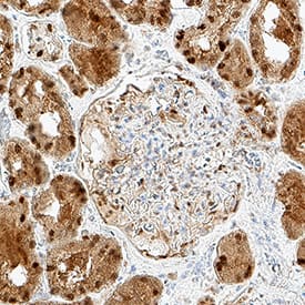 Immunohistochemistry MTAP Antibody (1113601) [Unconjugated]