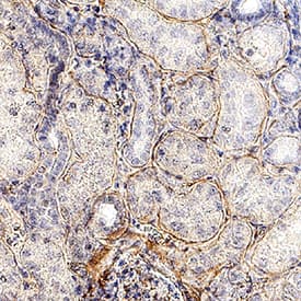 Collagen IV  alpha 1 was detected in immersion fixed paraffin-embedded sections of human kidney using Mouse Anti-Human Collagen IV  alpha 1 Monoclonal Antibody (Catalog # MAB11758) at 5 µg/ml overnight at 4 &deg;C. Before incubation with the primary antibody, tissue was subjected to heat-induced epitope retrieval using VisUCyte Antigen Retrieval Reagent-Basic (Catalog # VCTS021). Tissue was stained using the HRP-conjugated Anti-Mouse IgG Secondary Antibody (Catalog # HAF007) and counterstained with hematoxylin (blue). Specific staining was localized to the basement membrane. View our protocol for Chromogenic IHC Staining of Paraffin-embedded Tissue Sections.