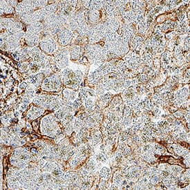 Collagen IV  alpha 1 was detected in immersion fixed paraffin-embedded sections of human liver using Mouse Anti-Human Collagen IV  alpha 1 Monoclonal Antibody (Catalog # MAB11758) at 5 µg/ml overnight at 4 &deg;C. Before incubation with the primary antibody, tissue was subjected to heat-induced epitope retrieval using VisUCyte Antigen Retrieval Reagent-Basic (Catalog # VCTS021). Tissue was stained using the HRP-conjugated Anti-Mouse IgG Secondary Antibody (Catalog # HAF007) and counterstained with hematoxylin (blue). Specific staining was localized to the basement membrane. View our protocol for Chromogenic IHC Staining of Paraffin-embedded Tissue Sections.