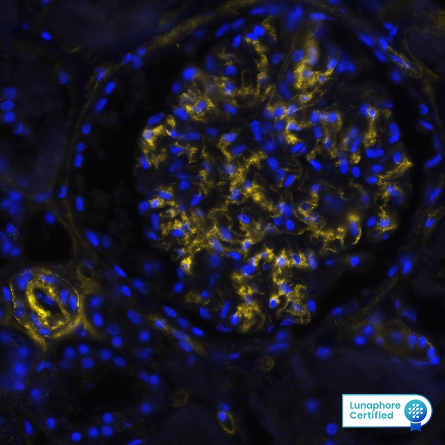 COL4A1 was detected in immersion fixed paraffin-embedded sections of human Kidney using Mouse Anti-Human COL4A1, Monoclonal Antibody (Catalog#MAB11758) at 15ug/mL at 37 ° Celsius for 8 minutes. Before incubation with the primary antibody, tissue underwent an all-in-one dewaxing and antigen retrieval preprocessing using PreTreatment Module (PT Module)and Dewax and HIER Buffer H (pH 9; Epredia Catalog #TA-999-DHBH).Tissue was stained using the Alexa Fluor™ 647 Goat anti-Mouse IgG Secondary Antibody at 1:200 at 37 ° Celsius for 2 minutes. (Yellow; Lunaphore Catalog # DR647MS) and counterstained with DAPI (blue; Lunaphore Catalog # DR100). Specific staining was localized to the extracellular space. Protocol available in COMET™ Panel Builder.