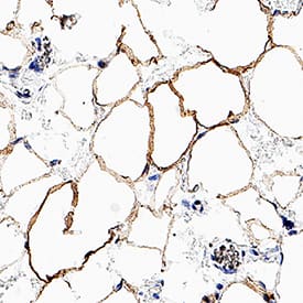 Immunohistochemistry Perilipin-4 Antibody (1114804) [Unconjugated]