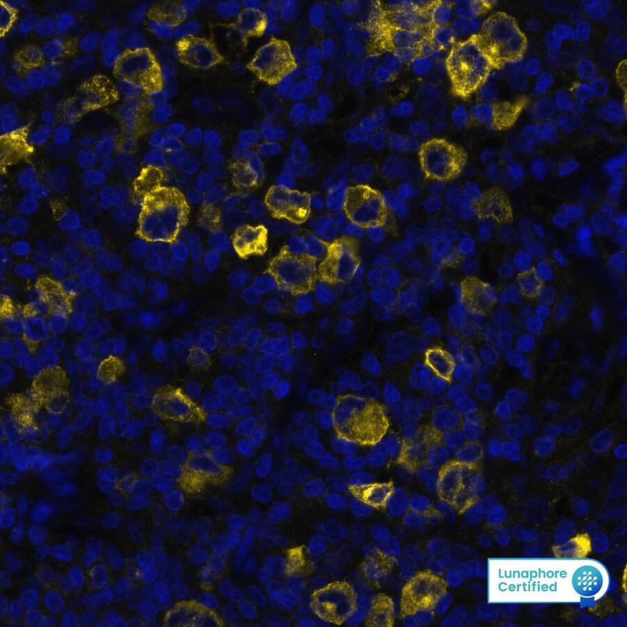 CD30/TNFRSF8 was detected in immersion fixed paraffin-embedded sections of human Hodgkin’s Lymphoma using Mouse Anti-Human CD30/TNFRSF8, Monoclonal Antibody (Catalog# MAB11768) at 25ug/mL at 37° Celsius for 16 minutes. Before incubation with the primary antibody, tissue underwent an all-in-one dewaxing and antigen retrieval preprocessing using PreTreatment Module (PT Module) and Dewax and HIER Buffer H (pH 9; Epredia Catalog #TA-999-DHBH). Tissue was stained using the Alexa Fluor™ 647 Goat anti-Mouse IgG Secondary Antibody at 1:200 at 37 ° Celsius for 2 minutes. (Yellow; Lunaphore Catalog # DR647MS) and counterstained with DAPI (blue; Lunaphore Catalog # DR100). Specific staining was localized to the membrane and cytoplasm. Protocol available in COMET™ Panel Builder.​