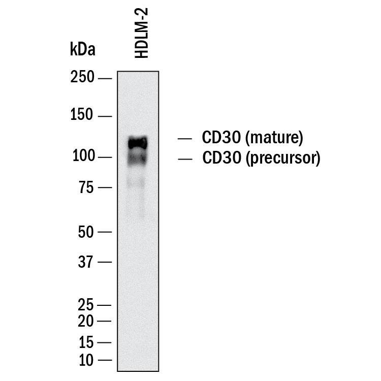 Western Blot shows lysates of HDLM‑2 human Hodgkin’s lymphoma cell line. PVDF membrane was probed with 2 µg/ml of Mouse Anti-Human CD30/TNFRSF8 Monoclonal Antibody (Catalog # MAB11768) followed by HRP-conjugated Anti-Mouse IgG Secondary Antibody (Catalog # HAF018). Specific bands were detected for CD30/TNFRSF8 at approximately 90kDa and 120 kDa (as indicated).  This experiment was conducted under reducing conditions and using Western Blot Buffer Group 1.
