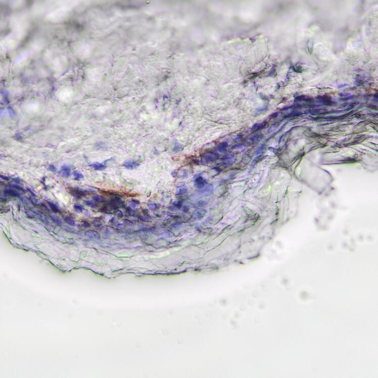 Laminin  alpha 3/Laminin‑5 was detected in perfusion fixed frozen sections of human skin using Mouse Anti-Human Laminin  alpha 3/Laminin‑5 Monoclonal Antibody (Catalog # MAB11784) at 1.5 µg/ml overnight at 4 &deg;C. Before incubation with the primary antibody, tissue was subjected to heat-induced epitope retrieval using VisUCyte Antigen Retrieval Reagent-Basic (Catalog # VCTS021). Tissue was stained using the HRP-conjugated Anti-Mouse IgG Secondary Antibody (Catalog # HAF007) and counterstained with hematoxylin (blue). Specific staining was localized to the basement membrane in frozen human Skin. View our protocol for Chromogenic IHC Staining of Frozen Tissue Sections.