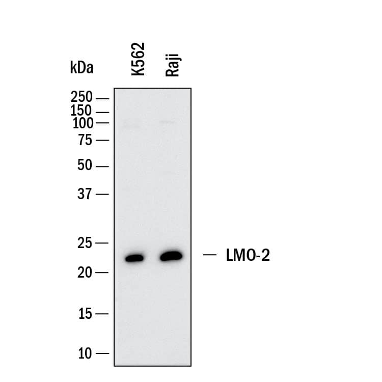 Western Blot shows lysates of K562 human chronic myelogenous leukemia cell line and Raji human Burkitt's lymphoma cell line. PVDF membrane was probed with 0.1 µg/ml of Mouse Anti-Human LMO2 Monoclonal Antibody (Catalog # MAB11790) followed by HRP-conjugated Anti-Mouse IgG Secondary Antibody (HAF018). A specific band was detected for LMO2 at approximately 22 kDa (as indicated).  This experiment was conducted under reducing conditions and using Western Blot Buffer Group 1.