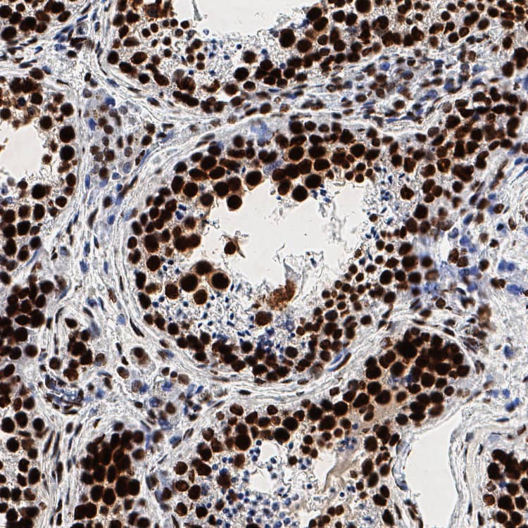 FUS was detected in immersion fixed paraffin-embedded sections of human testis using Mouse Anti-Human FUS Monoclonal Antibody (Catalog # MAB11793) at 5 µg/ml overnight at 4 &deg;C. Before incubation with the primary antibody, tissue was subjected to heat-induced epitope retrieval using VisUCyte Antigen Retrieval Reagent-Basic (VCTS021). Tissue was stained using the HRP-conjugated Anti-Mouse IgG Secondary Antibody (HAF007) and counterstained with hematoxylin (blue). Specific staining was localized to the nucleus. View our protocol for Chromogenic IHC Staining of Paraffin-embedded Tissue Sections.