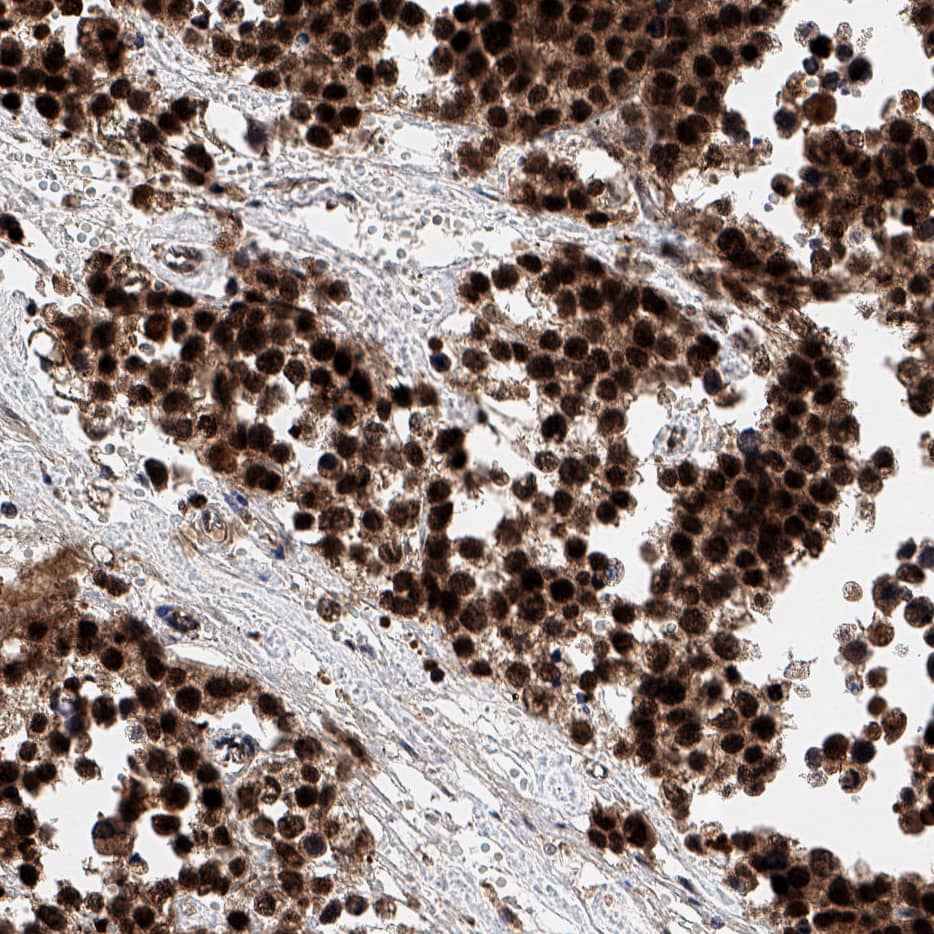 Immunohistochemistry BEND2 Antibody (1121524) [Unconjugated]