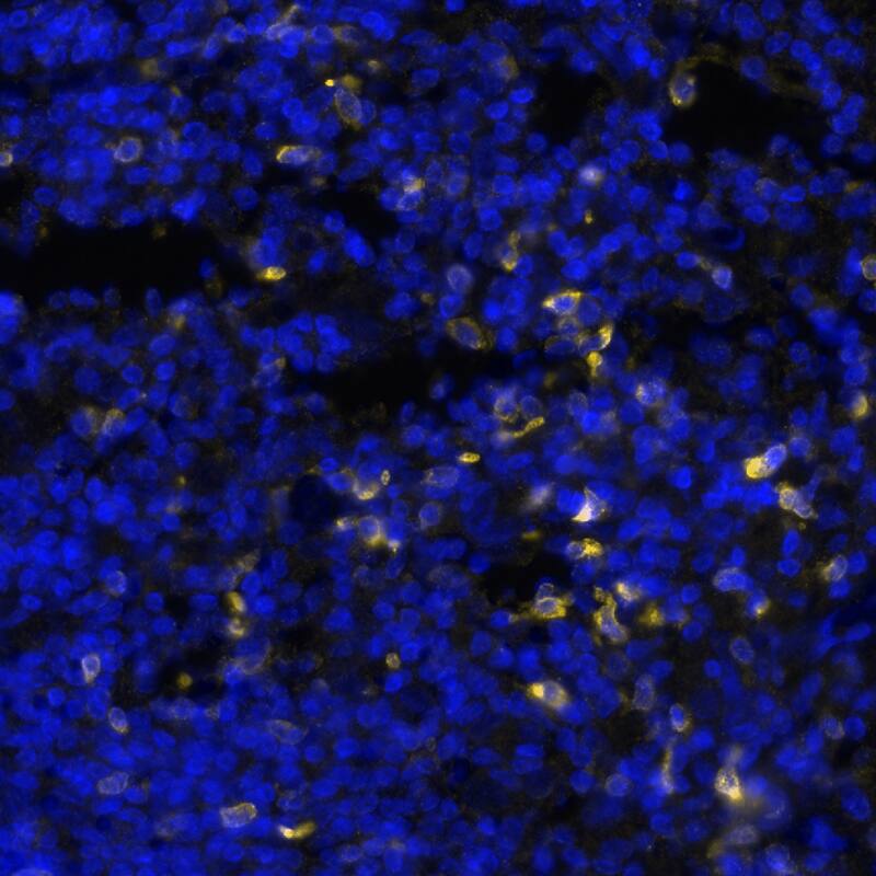 Neprilysin/CD10 was detected in immersion fixed paraffin-embedded sections of B-Cell Lymphoma using Mouse Anti-Human Neprilysin/CD10 Monoclonal Antibody (Catalog # MAB11821) at 0.5 µg/mL at 37 ° Celsius for 4 minutes. Before incubation with the primary antibody, tissue underwent an all-in-one dewaxing and antigen retrieval preprocessing using PreTreatment Module (PT Module) and Dewax and HIER Buffer H (pH 9; Epredia Catalog # TA-999-DHBH). Tissue was stained using the Alexa Fluor™ 647 Goat anti-Mouse IgG Secondary Antibody at 1:200 at 37 ° Celsius for 2 minutes. (Yellow; Lunaphore Catalog # DR647MS) and counterstained with DAPI (blue; Lunaphore Catalog # DR100). Specific staining was localized to the cell membrane. Protocol available in COMET™ Panel Builder.