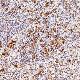 Fc gamma  RI/CD64 was detected in immersion fixed paraffin-embedded sections of human spleen tissue using Mouse Anti-Human Fc gamma  RI/CD64 Monoclonal Antibody (Catalog # MAB12574) at 5 µg/mL for 1 hour at room temperature followed by incubation with the Anti-Mouse IgG VisUCyte™ HRP Polymer Antibody (VC001). Before incubation with the primary antibody, tissue was subjected to heat-induced epitope retrieval using Antigen Retrieval Reagent-Basic (CTS013). Tissue was stained using DAB (brown) and counterstained with hematoxylin (blue). Specific staining was localized to cytoplasm in lymphocytes. Staining was performed using our IHC Staining with VisUCyte HRP Polymer Detection Reagents protocol.