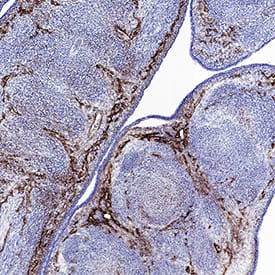 Endoglin/CD105 was detected in immersion fixed frozen sections of mouse embryo using Rat Anti-Mouse Endoglin/CD105 Monoclonal Antibody (Catalog # MAB1320) at 3 µg/ml for 1 hour at room temperature followed by incubation with the Anti-Rat IgG VisUCyte™ HRP Polymer Antibody (Catalog # VC005) or the HRP-conjugated Anti-Rat IgG Secondary Antibody (Catalog # HAF005). Tissue was stained using DAB (brown) and counterstained with hematoxylin (blue). Specific staining was localized to endothelial cells of developing limbs. View our protocol for Chromogenic IHC Staining of Frozen Tissue Sections.