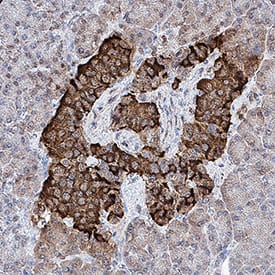 Proinsulin was detected in immersion fixed paraffin-embedded sections of human pancreas using Mouse Anti-Human/Mouse Proinsulin Monoclonal Antibody (Catalog # MAB13361) at 0.5 &micro;g/mL for 1 hour at room temperature followed by incubation with the Anti-Mouse IgG VisUCyte&trade;  HRP Polymer Antibody (VC001). Before incubation with the primary antibody, tissue was subjected to heat-induced epitope retrieval using Antigen Retrieval Reagent-Basic (CTS013). Tissue was stained using DAB (brown) and counterstained with hematoxylin (blue).  Specific staining was localized to cytoplasm and plasma membrane in islet cells. Staining was performed using our protocol for IHC Staining with VisUCyte HRP Polymer Detection Reagents.