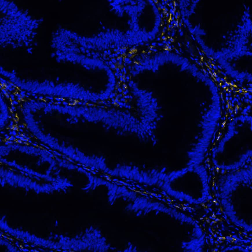 DC-SIGN was detected in immersion fixed paraffin-embedded sections of human colon using Mouse Anti-Human DC-SIGN Monoclonal Antibody (Catalog # MAB161) at 0.5 µg/mL at 37 ° Celsius for 2 minutes. Before incubation with the primary antibody, tissue underwent an all-in-one dewaxing and antigen retrieval preprocessing using PreTreatment Module (PT Module) and Dewax and HIER Buffer H (pH 9; Epredia Catalog # TA-999-DHBH). Tissue was stained using the Alexa Fluor™ 647 Goat anti-Mouse IgG Secondary Antibody at 1:200 at 37 ° Celsius for 2 minutes. (Yellow; Lunaphore Catalog # DR647MS) and counterstained with DAPI (blue; Lunaphore Catalog # DR100). Specific staining was localized to the membrane and cyoplasm. Protocol available in COMET™ Panel Builder.​
