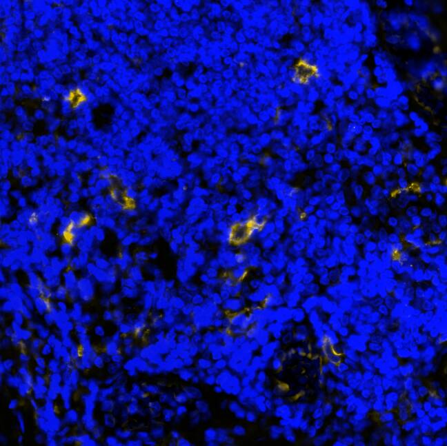 DC-SIGN was detected in immersion fixed paraffin-embedded sections of human lymph node using Mouse Anti-Human DC-SIGN Monoclonal Antibody (Catalog # MAB161) at 0.5 µg/mL at 37 ° Celsius for 2 minutes. Before incubation with the primary antibody, tissue underwent an all-in-one dewaxing and antigen retrieval preprocessing using PreTreatment Module (PT Module) and Dewax and HIER Buffer H (pH 9; Epredia Catalog # TA-999-DHBH). Tissue was stained using the Alexa Fluor™ 647 Goat anti-Mouse IgG Secondary Antibody at 1:200 at 37 ° Celsius for 2 minutes. (Yellow; Lunaphore Catalog # DR647MS) and counterstained with DAPI (blue; Lunaphore Catalog # DR100). Specific staining was localized to the membrane and cyoplasm. Protocol available in COMET™ Panel Builder.