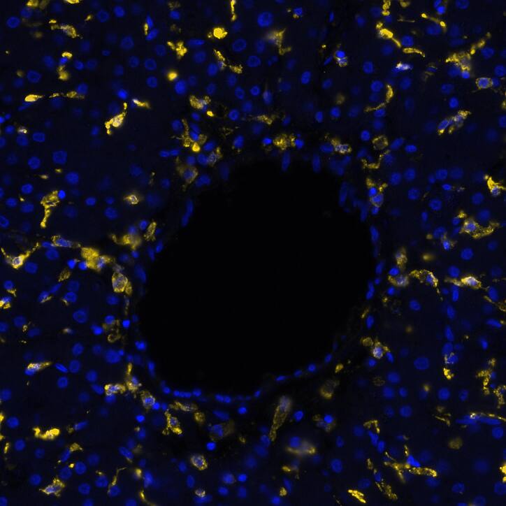DC-SIGN was detected in immersion fixed paraffin-embedded sections of human liver using Mouse Anti-Human DC-SIGN Monoclonal Antibody (Catalog # MAB161) at 0.5 µg/mL at 37 ° Celsius for 2 minutes. Before incubation with the primary antibody, tissue underwent an all-in-one dewaxing and antigen retrieval preprocessing using PreTreatment Module (PT Module) and Dewax and HIER Buffer H (pH 9; Epredia Catalog # TA-999-DHBH). Tissue was stained using the Alexa Fluor™ 647 Goat anti-Mouse IgG Secondary Antibody at 1:200 at 37 ° Celsius for 2 minutes. (Yellow; Lunaphore Catalog # DR647MS) and counterstained with DAPI (blue; Lunaphore Catalog # DR100). Specific staining was localized to the membrane and cyoplasm. Protocol available in COMET™ Panel Builder.