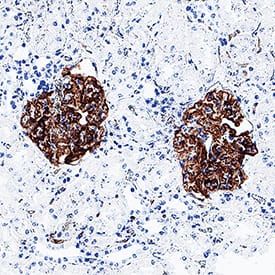 Podocalyxin was detected in immersion fixed paraffin-embedded sections of human kidney using Mouse Anti-Human Podocalyxin Monoclonal Antibody (Catalog # MAB1658) at 0.05 µg/ml for 1 hour at room temperature followed by incubation with the Anti-Mouse IgG VisUCyte™ HRP Polymer Antibody (Catalog # VC001) or the HRP-conjugated Anti-Mouse IgG Secondary Antibody (Catalog # HAF007). Before incubation with the primary antibody, tissue was subjected to heat-induced epitope retrieval using VisUCyte Antigen Retrieval Reagent-Basic (Catalog # VCTS021). Tissue was stained using DAB (brown) and counterstained with hematoxylin (blue). Specific staining was localized to glomerular epithelial cells. View our protocol for IHC Staining with VisUCyte HRP Polymer Detection Reagents.