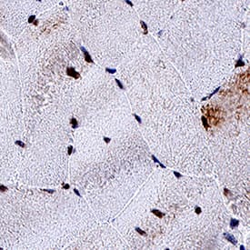 Pax7 was detected in immersion fixed paraffin-embedded sections of human skeletal muscle using Mouse Anti-Human/Mouse/Rat/Chicken Pax7 Monoclonal Antibody (Catalog # MAB1675) at 5 &micro;g/mL for 1 hour at room temperature followed by incubation with the Anti-Mouse IgG VisUCyte&trade;  HRP Polymer Antibody (VC001). Before incubation with the primary antibody, tissue was subjected to heat-induced epitope retrieval using Antigen Retrieval Reagent-Basic (CTS013). Tissue was stained using DAB (brown) and counterstained with hematoxylin (blue).  Specific staining was localized to cell nuclei. Staining was performed using our protocol for IHC Staining with VisUCyte HRP Polymer Detection Reagents.