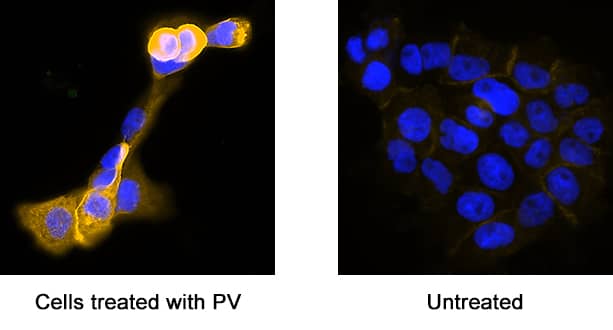 Immunocytochemistry Phospho-Tyrosine Antibody (179003) [Unconjugated]