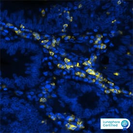 CD11b/Integrin alpha M Antibody was detected in immersion fixed paraffin-embedded sections of human colon cancer using Mouse Anti-Human CD11b/Integrin alpha M Monoclonal Antibody (Catalog # MAB16992) at 15ug/mL at 37 ° Celsius for 4 minutes. Before incubation with the primary antibody, tissue underwent an all-in-one dewaxing and antigen retrieval preprocessing using PreTreatment Module (PT Module) and Dewax and HIER Buffer H (pH 9; Epredia Catalog # TA-999-DHBH). Tissue was stained using the Alexa Fluor™ 647 Goat anti-Mouse IgG Secondary Antibody at 1:200 at 37 ° Celsius for 2 minutes. (Yellow; Lunaphore Catalog # DR647MS) and counterstained with DAPI (blue; Lunaphore Catalog # DR100). Specific staining was localized to the membrane. Protocol available in COMET™ Panel Builder.