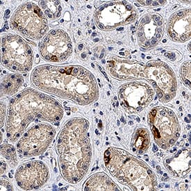 TIM‑1/KIM‑1/HAVCR was detected in immersion fixed paraffin-embedded sections of human kidney tissue using Rabbit Anti-Human TIM‑1/KIM‑1/HAVCR Monoclonal Antibody (Catalog # MAB17504) at 3 µg/mL for 1 hour at room temperature followed by incubation with the Anti-Rabbit IgG VisUCyte™ HRP Polymer Antibody (VC003). Before incubation with the primary antibody, tissue was subjected to heat-induced epitope retrieval using Antigen Retrieval Reagent-Basic (CTS013). Tissue was stained using DAB (brown) and counterstained with hematoxylin (blue). Specific staining was localized to cell membrane in convoluted tubules. Staining was performed using our protocol for IHC Staining with VisUCyte HRP Polymer Detection Reagents.