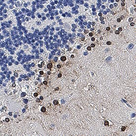 S100B was detected in immersion fixed paraffin-embedded sections of human brain (cerebellum) using Mouse Anti-Human S100B Monoclonal Antibody (Catalog # MAB18203) at 5 µg/mL for 1 hour at room temperature followed by incubation with the Anti-Mouse IgG VisUCyte™ HRP Polymer Antibody (VC001). Before incubation with the primary antibody, tissue was subjected to heat-induced epitope retrieval using Antigen Retrieval Reagent-Basic (CTS013). Tissue was stained using DAB (brown) and counterstained with hematoxylin (blue). Specific staining was localized to nuclei in stellate cells. Staining was performed using our protocol for IHC Staining with VisUCyte HRP Polymer Detection Reagents.