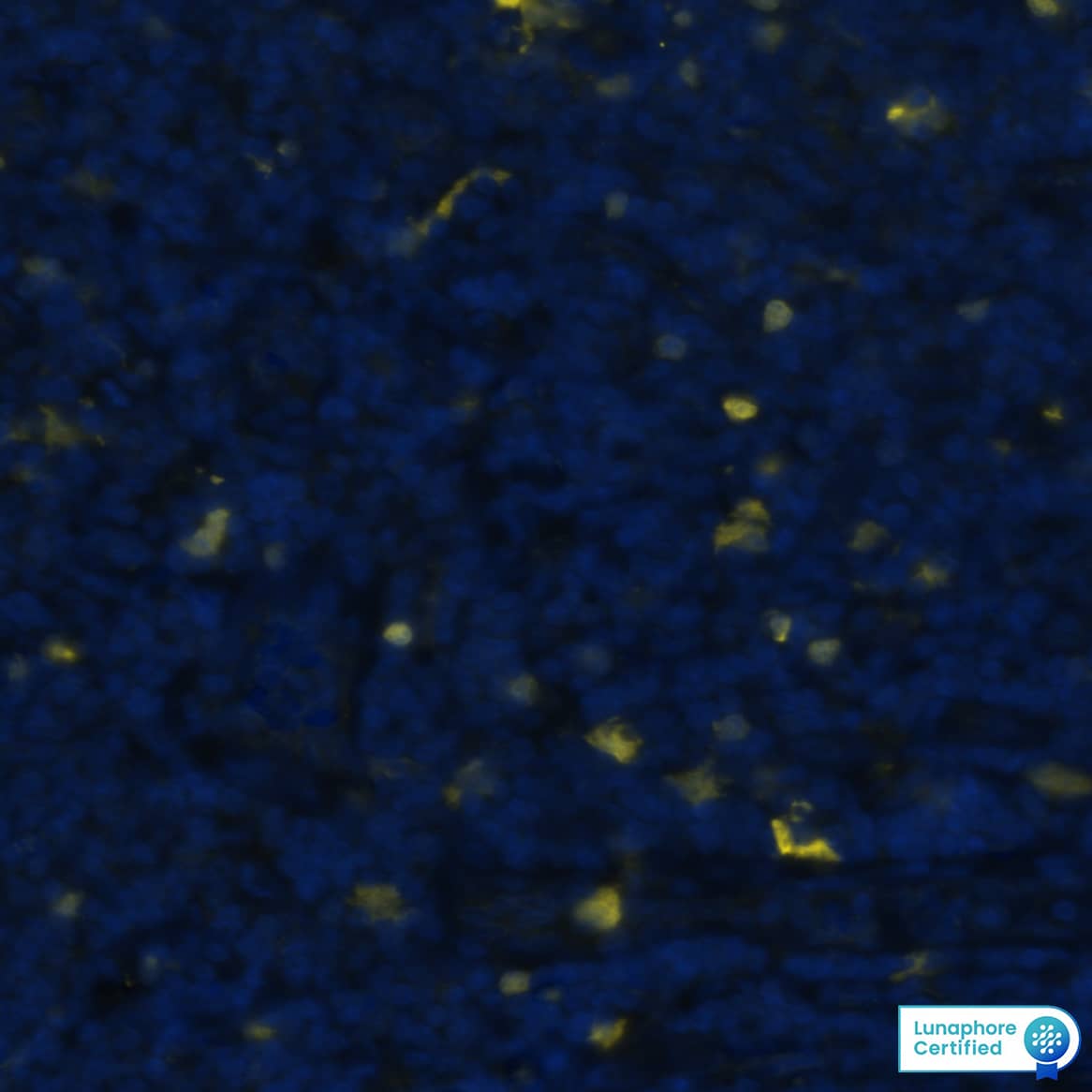 S100B was detected in immersion fixed paraffin-embedded sections of human tonsil using Mouse Anti-Human S100B Monoclonal Antibody (MAB18203) at 0.5 μg/mL at 37 ° Celsius for 4 minutes. Before incubation with the primary antibody, tissue underwent an all-in-one dewaxing and antigen retrieval preprocessing using PreTreatment Module (PT Module) and Dewax and HIER Buffer H (pH 9). Tissue was stained using the Alexa Fluor™ 647 Goat anti-Mouse IgG Secondary Antibody at 1:200 at 37° Celsius for 2 minutes. (Yellow; Lunaphore Catalog # DR647MS) and counterstained with DAPI (blue; Lunaphore Catalog # DR100).Specific staining was localized to the cytoplasm and nucleus. Protocol available in COMET™ Panel Builder.