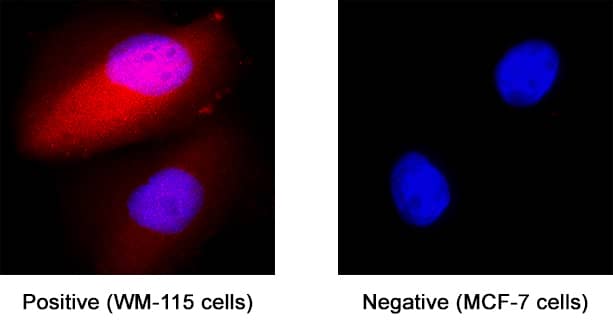S100B was detected in immersion fixed WM‑115 human malignant melanoma cell line (positive staining) and MCF‑7 human breast cancer cell line (negative staining) using Mouse Anti-Human S100B Monoclonal Antibody (Catalog # MAB18204) at 8 µg/mL for 3 hours at room temperature. Cells were stained using the NorthernLights™ 557-conjugated Anti-Mouse IgG Secondary Antibody (red; NL007) and counterstained with DAPI (blue). Specific staining was localized to cytoplasm and nuclei. Staining was performed using our protocol for Fluorescent ICC Staining of Non-adherent Cells.
