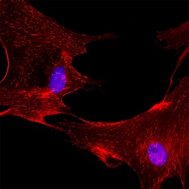 Immunocytochemistry Integrin alpha 5/CD49e Antibody (238307) [Unconjugated]