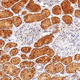 LRIG2 was detected in immersion fixed paraffin-embedded sections of human kidney using Mouse Anti-Human LRIG2 Monoclonal Antibody (Catalog # MAB19411) at 1.7 &micro;g/mL for 1 hour at room temperature followed by incubation with the Anti-Mouse IgG VisUCyte&trade; HRP Polymer Antibody (VC001). Before incubation with the primary antibody, tissue was subjected to heat-induced epitope retrieval using Antigen Retrieval Reagent-Basic (CTS013). Tissue was stained using DAB (brown) and counterstained with hematoxylin (blue). Specific staining was localized to cytoplasm in convoluted tubules. Staining was performed using our protocol for IHC Staining with VisUCyte HRP Polymer Detection Reagents.