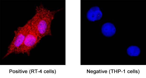 IL‑1 alpha /IL‑1F1 was detected in immersion fixed RT‑4 human urinary bladder transitional cell papilloma cell line (positive staining) and THP‑1 human acute monocytic leukemia cell line (negative staining) using Mouse Anti-Human IL‑1 alpha /IL‑1F1 Monoclonal Antibody (Catalog # MAB2003) at 8 µg/mL for 3 hours at room temperature. Cells were stained using the NorthernLights™ 557-conjugated Anti-Mouse IgG Secondary Antibody (red; NL007) and counterstained with DAPI (blue). Specific staining was localized to cytoplasm. Staining was performed using our protocol for Fluorescent ICC Staining of Non-adherent Cells.