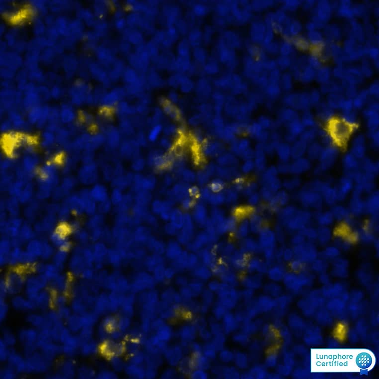 CD68 was detected in immersion fixed paraffin-embedded sections of human tonsil using Mouse Anti-Human CD68 Monoclonal Antibody (Catalog # MAB2040) at 20 µg/mL at 37 ° Celsius for 4 minutes. Before incubation with the primary antibody, tissue underwent an all-in-one dewaxing and antigen retrieval preprocessing using PreTreatment Module (PT Module) and Dewax and HIER Buffer H (pH 9). Tissue was stained using the Alexa Fluor™ 647 Goat anti-Mouse IgG Secondary Antibody at 1:200 at 37 ° Celsius for 2 minutes. (Yellow; Lunaphore Catalog # DR647MS) and counterstained with DAPI (blue; Lunaphore Catalog # DR100). Specific staining was localized to the cytoplasm.  Protocol available in COMET™ Panel Builder.