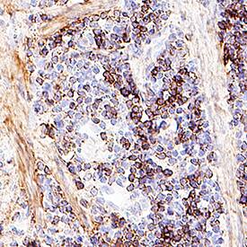 Akt was detected in immersion fixed paraffin-embedded sections of mouse spleen tissue using Mouse Anti-Human/Mouse/Rat Akt Pan Specific Monoclonal Antibody (Catalog # MAB2055) at 5 &micro;g/mL for 1 hour at room temperature followed by incubation with the Anti-Mouse IgG VisUCyte&trade; HRP Polymer Antibody (VC001). Before incubation with the primary antibody, tissue was subjected to heat-induced epitope retrieval using Antigen Retrieval Reagent-Basic (CTS013). Tissue was stained using DAB (brown) and counterstained with hematoxylin (blue). Specific staining was localized to cytoplasm in lymphocytes. Staining was performed using our IHC Staining with VisUCyte HRP Polymer Detection Reagents.