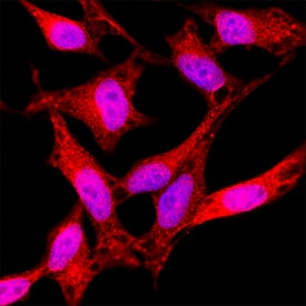 Smad4 was detected in immersion fixed HeLa human cervical epithelial carcinoma cell line using Mouse Anti-Human Smad4 Monoclonal Antibody (Catalog # MAB2097) at 3 &micro;g/mL for 3 hours at room temperature. Cells were stained using the NorthernLights&trade; 557-conjugated Anti-Mouse IgG Secondary Antibody (red; NL007) and counterstained with DAPI (blue). Specific staining was localized to cytoplasm. Staining was performed using our protocol for Fluorescent ICC Staining of Non-adherent Cells.